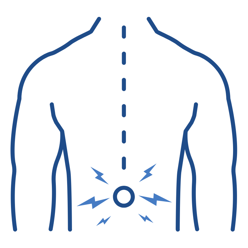 Cervical epidural steroid injection