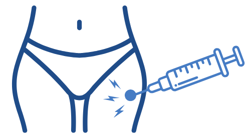 Caudal epidural steroid injection
