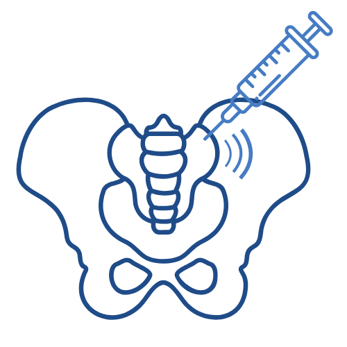 Sacroiliac joint injection